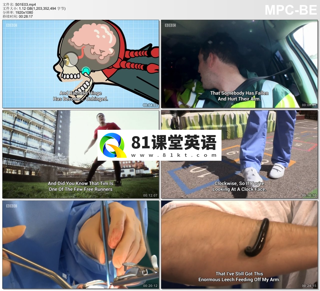 Operation Ouch 人体奥奇实验室 图片16 Operation Ouch 人体奥奇实验室 图片15