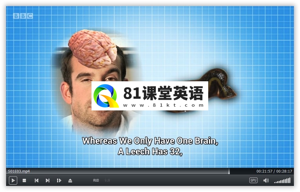 Operation Ouch 人体奥奇实验室 图片14 Operation Ouch 人体奥奇实验室 图片13